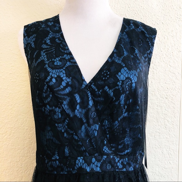 Black and Blue Lace Dress from ModCloth - Picture 2 of 8